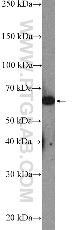 Western Blot (WB) analysis of MCF-7 cells using LOXL1 Polyclonal antibody (26608-1-AP)