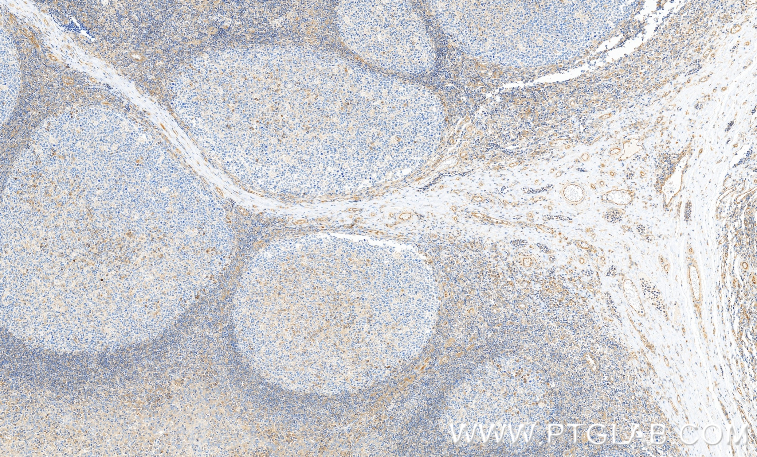 Immunohistochemistry (IHC) staining of human tonsillitis tissue using LOXL1 Recombinant monoclonal antibody (86534-2-RR)