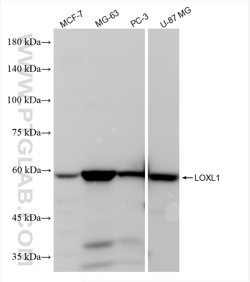 Western Blot (WB) analysis of various lysates using LOXL1 Recombinant monoclonal antibody (86534-2-RR)