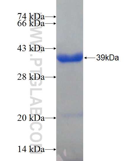 LOXL1 fusion protein Ag24293 SDS-PAGE