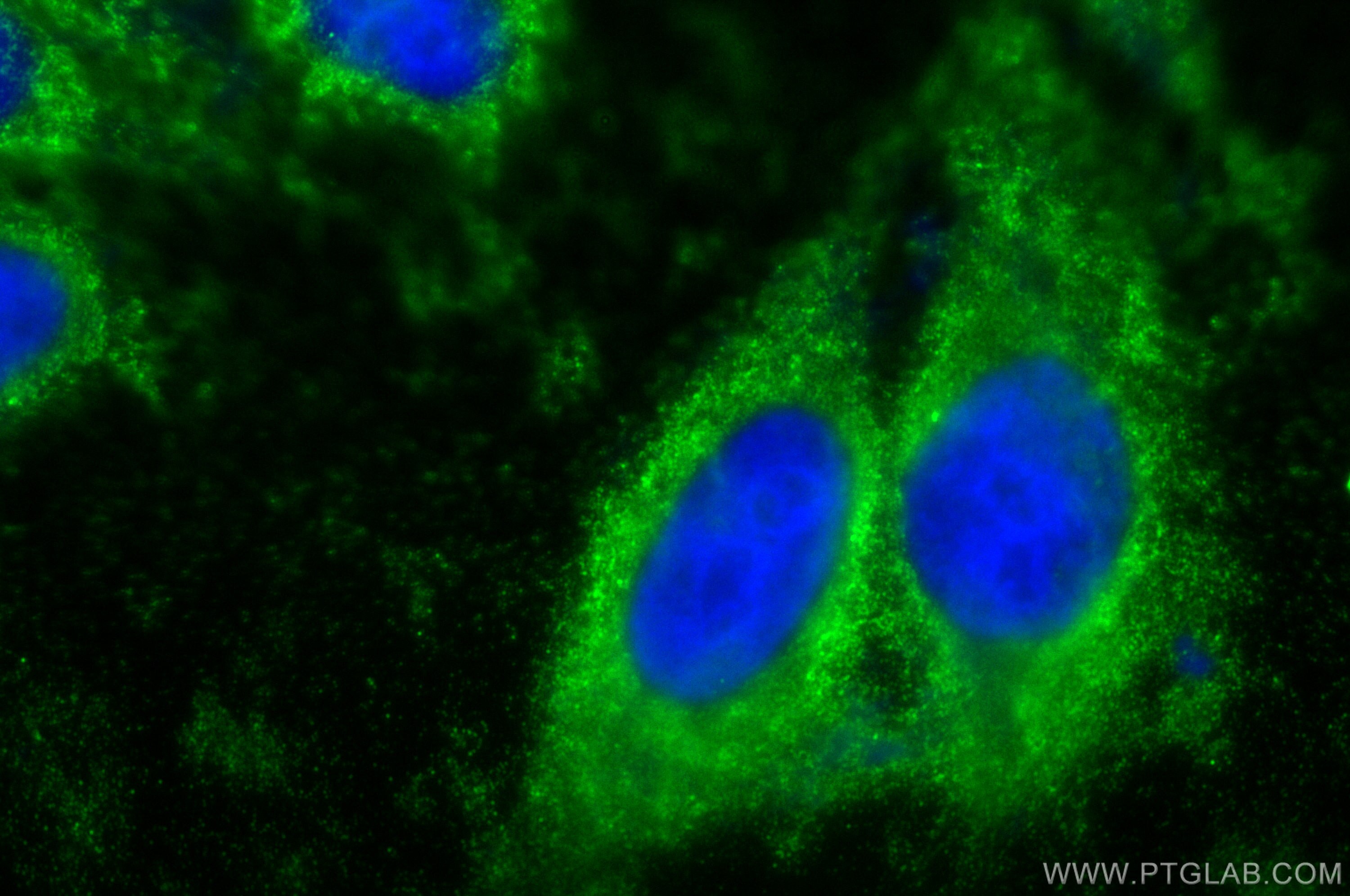 Immunofluorescence (IF) / fluorescent staining of HepG2 cells using LOXL2 Polyclonal antibody (15232-1-AP)