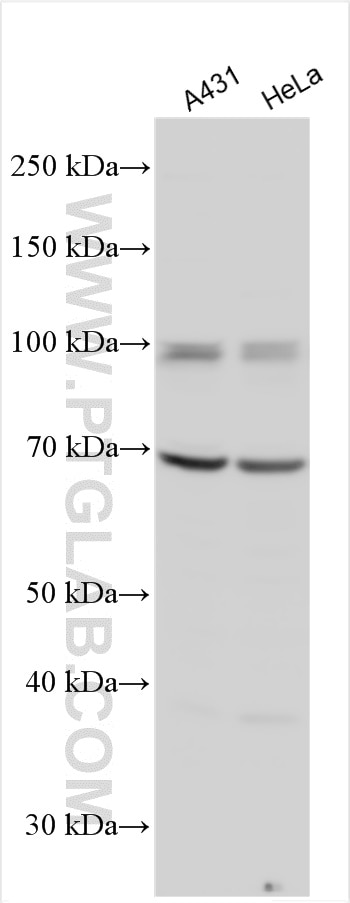 Western Blot (WB) analysis of various lysates using LOXL2 Polyclonal antibody (15232-1-AP)