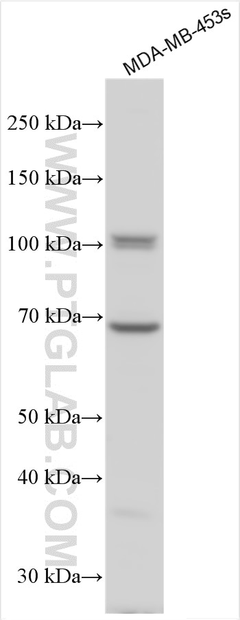 Western Blot (WB) analysis of various lysates using LOXL2 Polyclonal antibody (15232-1-AP)