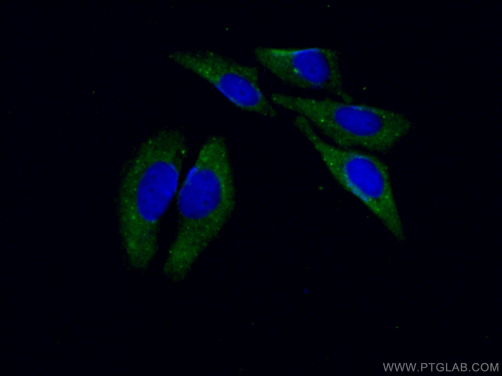 Immunofluorescence (IF) / fluorescent staining of HepG2 cells using LOXL2 Monoclonal antibody (67139-1-Ig)