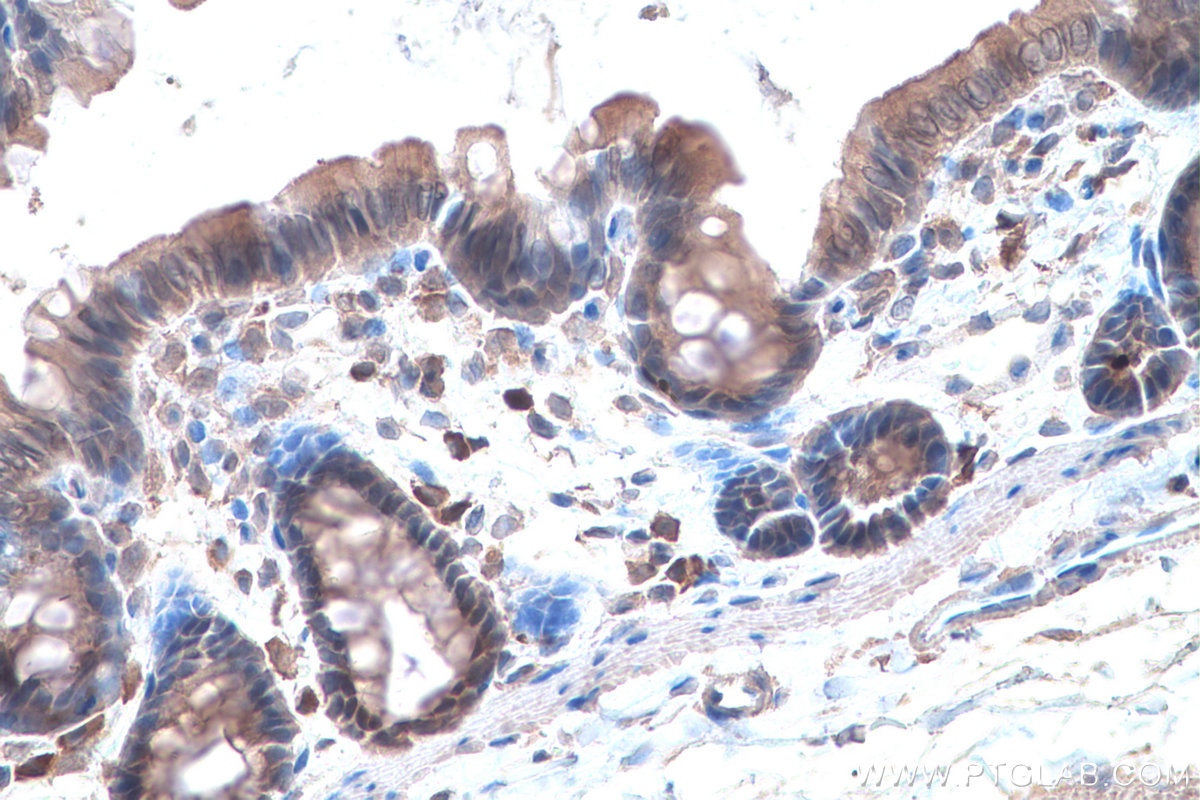 Immunohistochemistry (IHC) staining of rat colon tissue using LOXL2 Monoclonal antibody (67139-1-Ig)