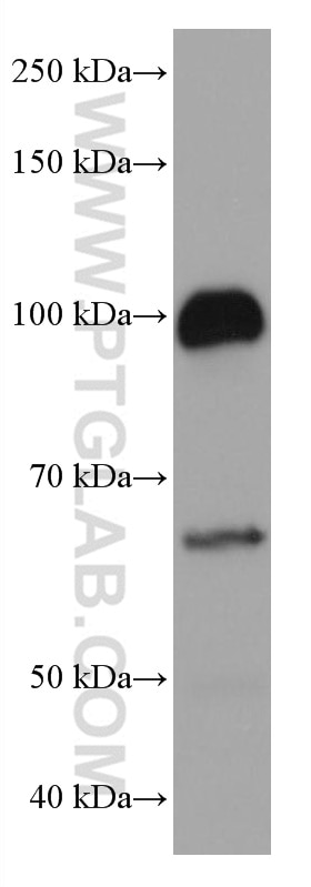 Western Blot (WB) analysis of human placenta tissue using LOXL2 Monoclonal antibody (67139-1-Ig)