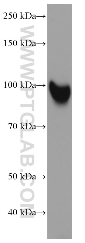 Western Blot (WB) analysis of A375 cells using LOXL2 Monoclonal antibody (67139-1-Ig)
