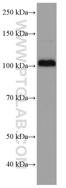 Western Blot (WB) analysis of A549 cells using LOXL2 Monoclonal antibody (67139-1-Ig)