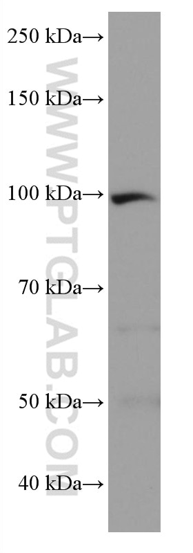 Western Blot (WB) analysis of human heart tissue using LOXL2 Monoclonal antibody (67139-1-Ig)