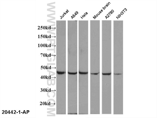 Western Blot (WB) analysis of multi-cells/tissue using EDG2 Polyclonal antibody (20442-1-AP)