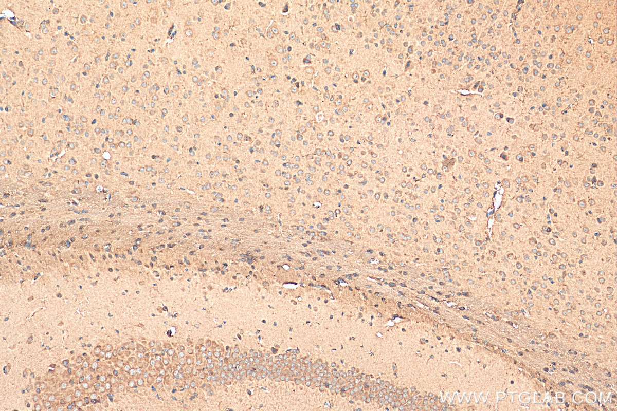 Immunohistochemistry (IHC) staining of mouse brain tissue using EDG2 Polyclonal antibody (20442-1-AP)