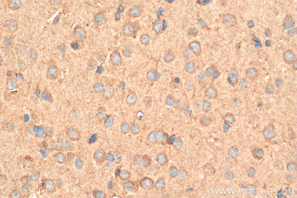 Immunohistochemistry (IHC) staining of mouse brain tissue using EDG2 Polyclonal antibody (20442-1-AP)