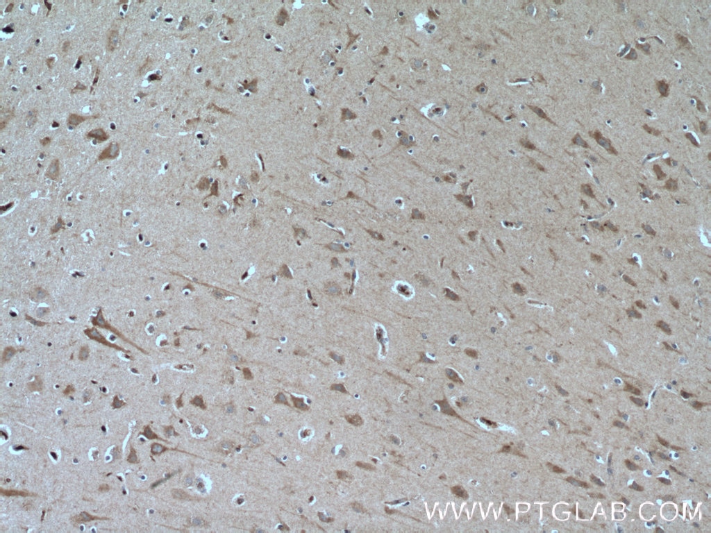 Immunohistochemistry (IHC) staining of human brain tissue using EDG2 Polyclonal antibody (20442-1-AP)