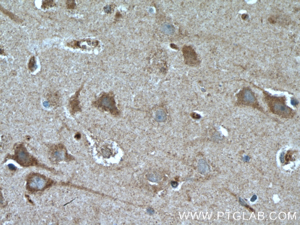 IHC staining of human brain using 20442-1-AP