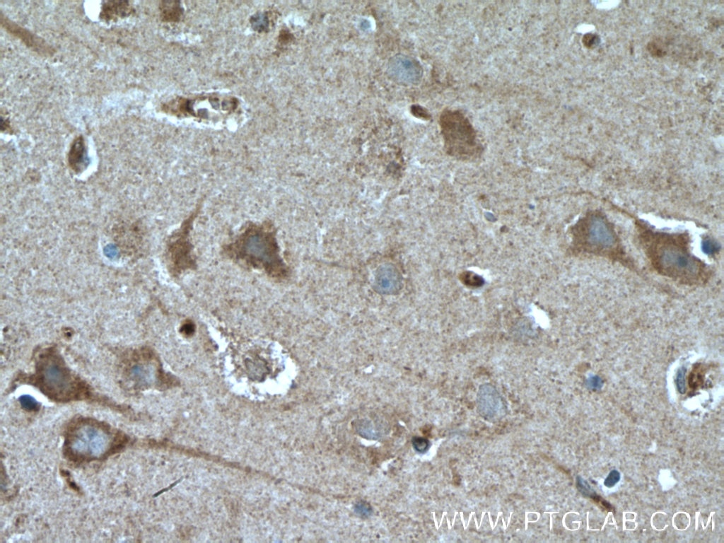 Immunohistochemistry (IHC) staining of human brain tissue using EDG2 Polyclonal antibody (20442-1-AP)