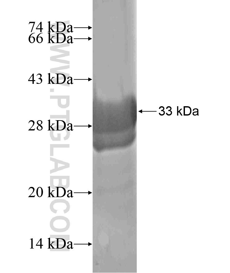 LPAR3 fusion protein Ag17925 SDS-PAGE
