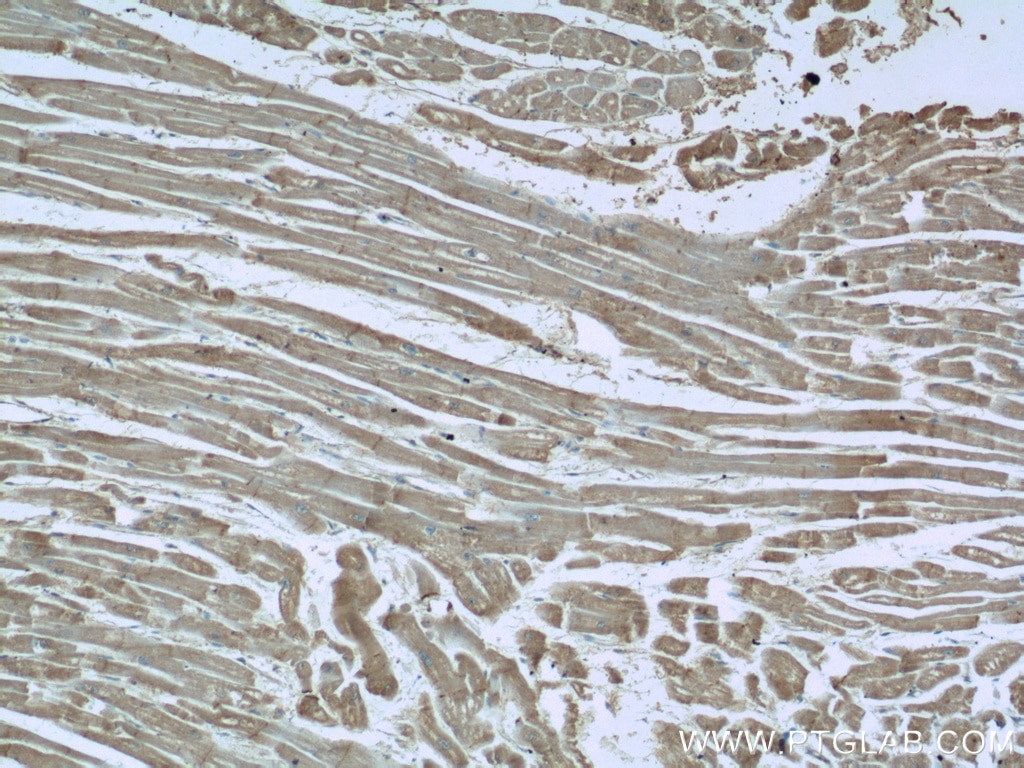 Immunohistochemistry (IHC) staining of human heart tissue using EDG7-Specific Polyclonal antibody (19509-1-AP)