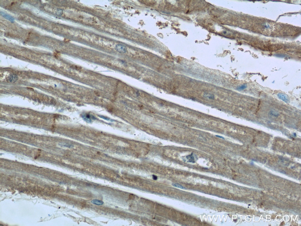 IHC staining of human heart using 19509-1-AP