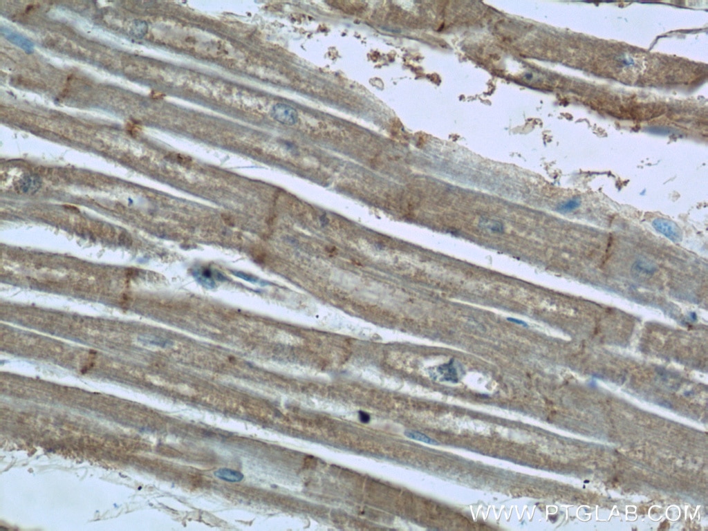 Immunohistochemistry (IHC) staining of human heart tissue using EDG7-Specific Polyclonal antibody (19509-1-AP)