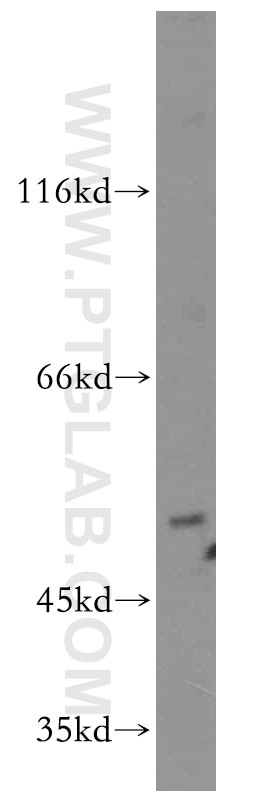 Western Blot (WB) analysis of PC-3 cells using EDG7-Specific Polyclonal antibody (19509-1-AP)