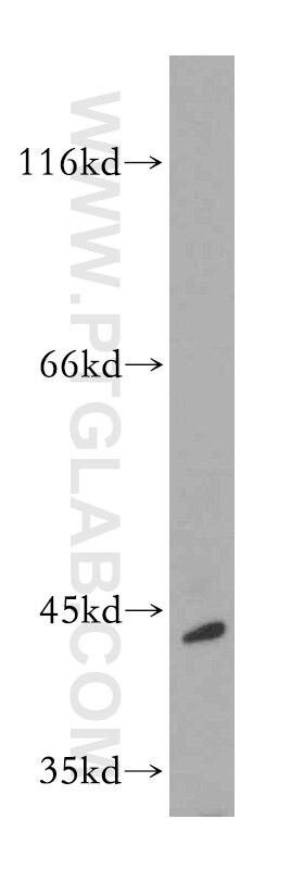 Western Blot (WB) analysis of mouse pancreas tissue using EDG7-Specific Polyclonal antibody (19509-1-AP)