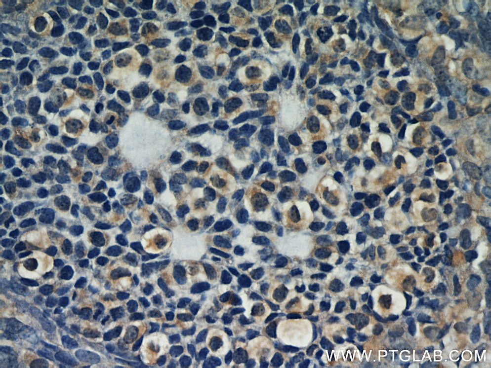 Immunohistochemistry (IHC) staining of human ovary tissue using LPAR4 Polyclonal antibody (22165-1-AP)