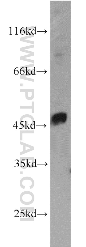 Western Blot (WB) analysis of mouse brain tissue using LPAR4 Polyclonal antibody (22165-1-AP)