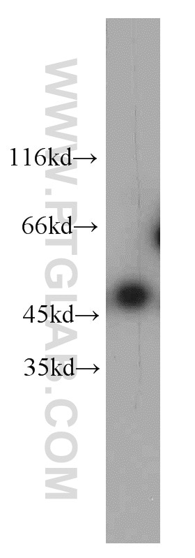 Western Blot (WB) analysis of HL-60 cells using LPAR4 Polyclonal antibody (22165-1-AP)