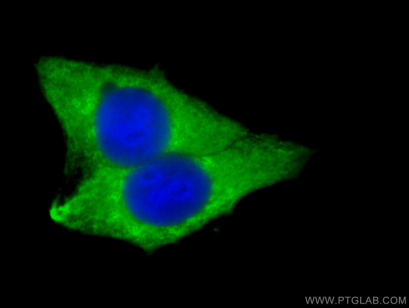 Immunofluorescence (IF) / fluorescent staining of MCF-7 cells using LPCAT1 Polyclonal antibody (16112-1-AP)