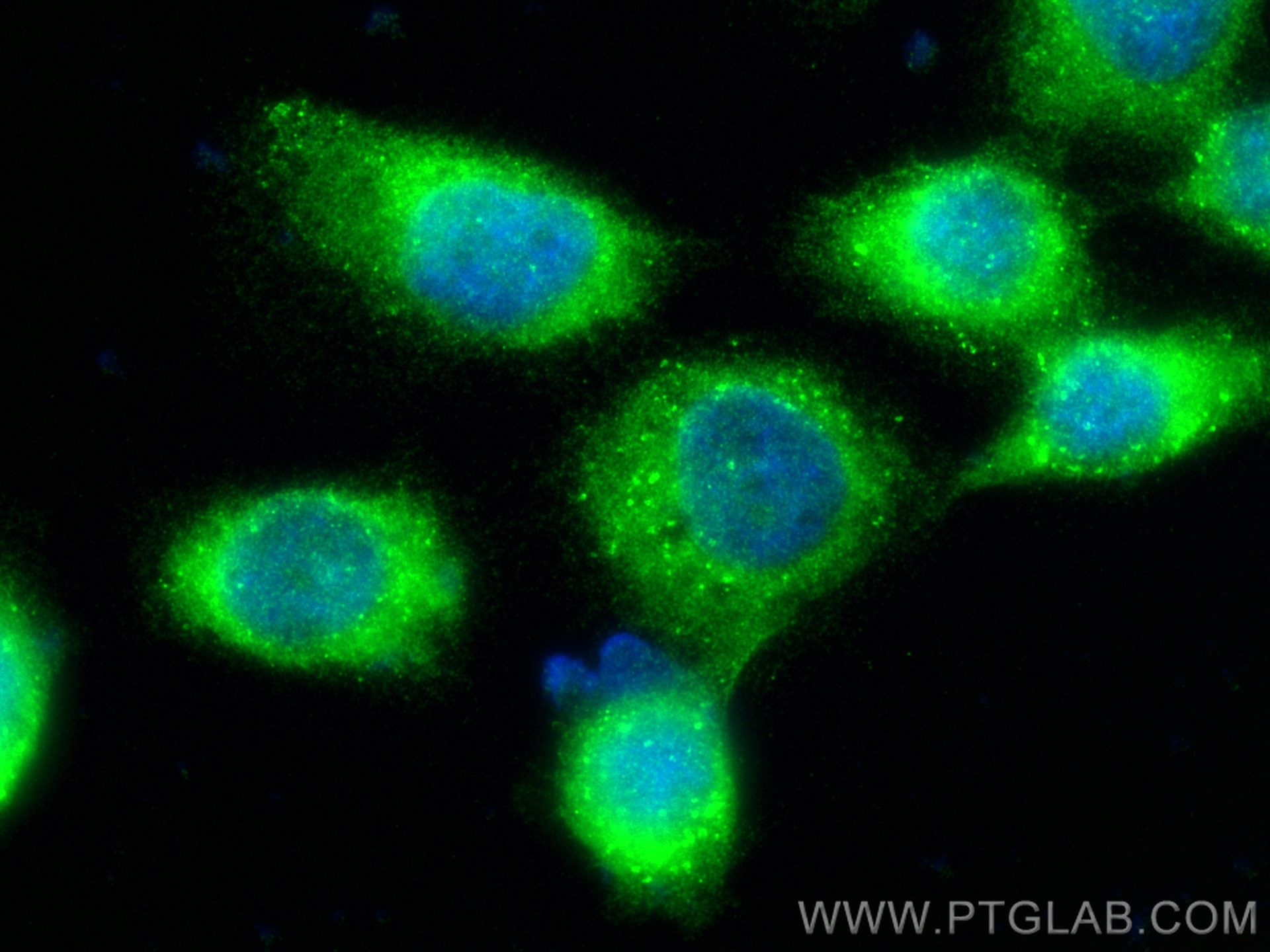 Immunofluorescence (IF) / fluorescent staining of A431 cells using LPCAT1 Polyclonal antibody (16112-1-AP)