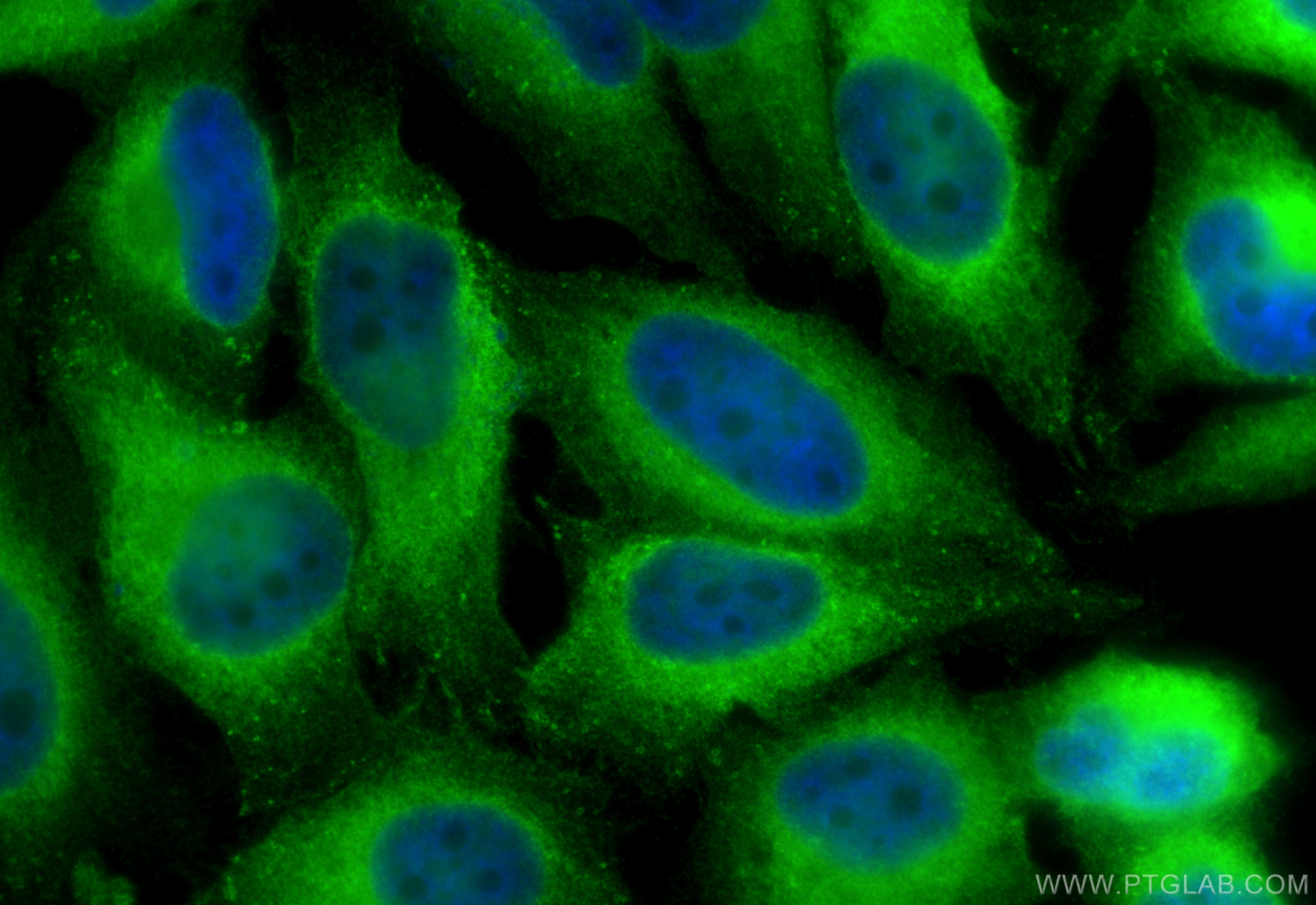 Immunofluorescence (IF) / fluorescent staining of HeLa cells using LPCAT1 Polyclonal antibody (16112-1-AP)