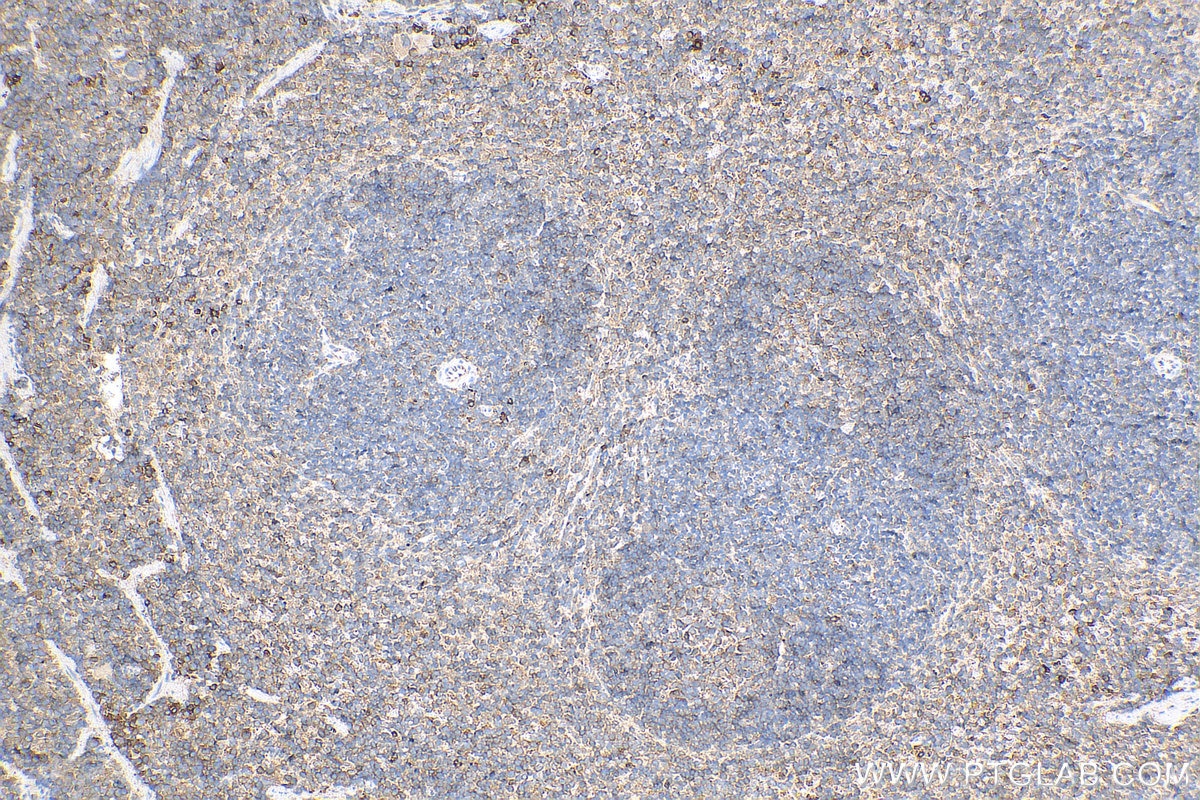 Immunohistochemistry (IHC) staining of mouse spleen tissue using LPCAT1 Polyclonal antibody (16112-1-AP)