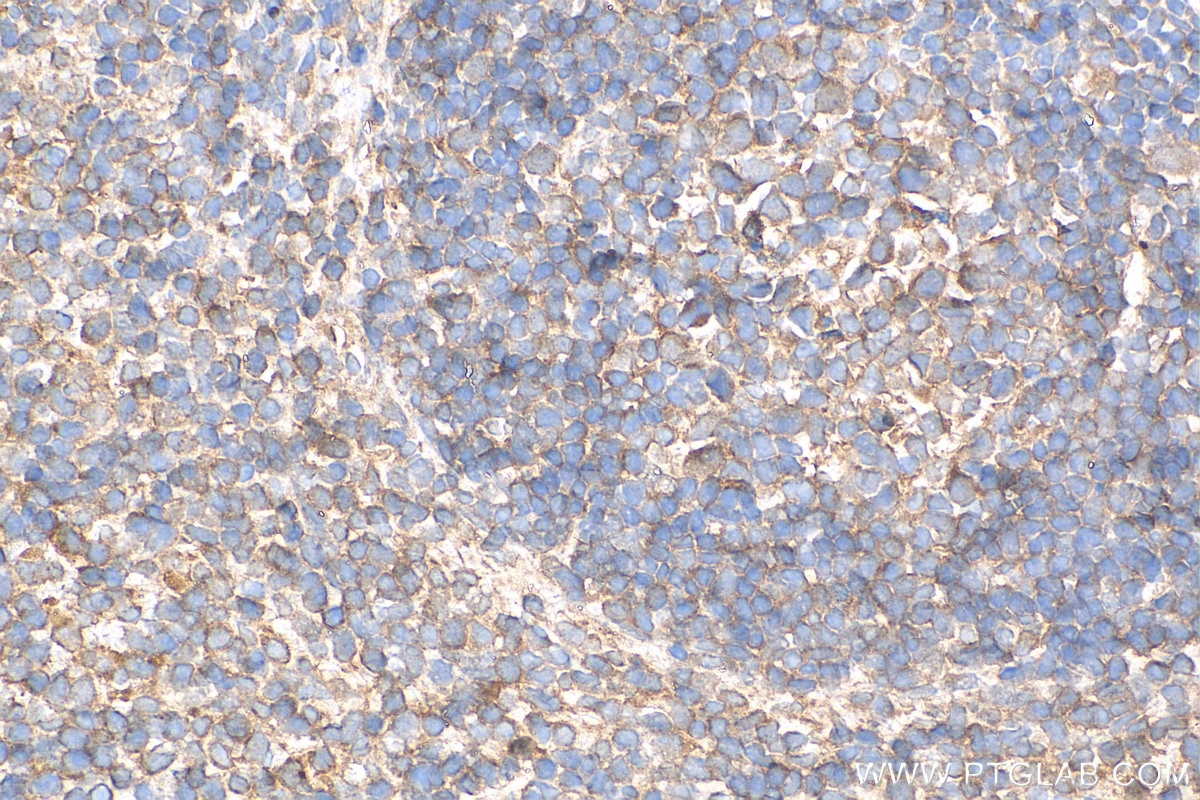 Immunohistochemistry (IHC) staining of mouse spleen tissue using LPCAT1 Polyclonal antibody (16112-1-AP)