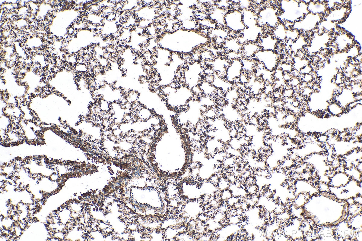 IHC staining of mouse lung using 16112-1-AP
