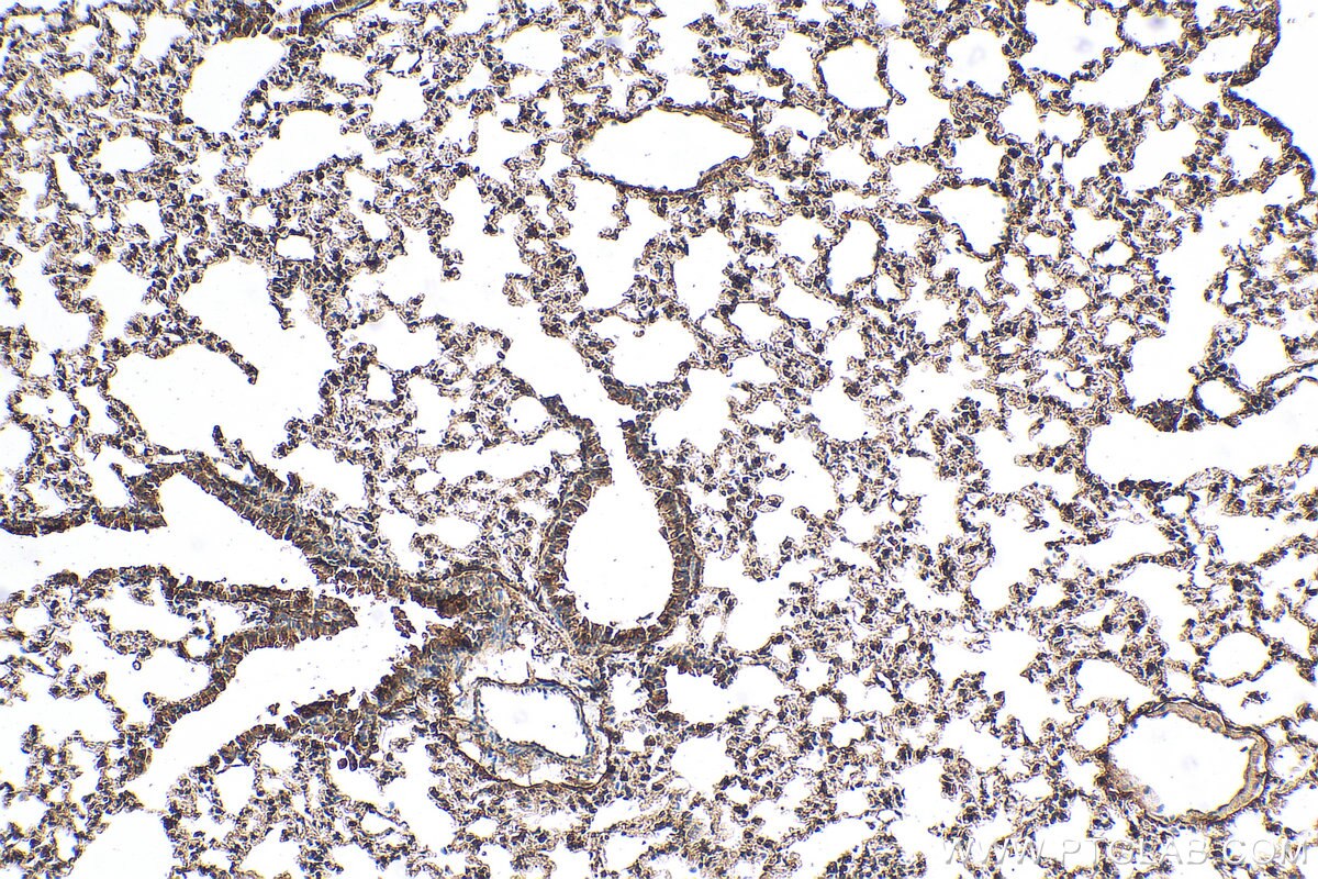 Immunohistochemistry (IHC) staining of mouse lung tissue using LPCAT1 Polyclonal antibody (16112-1-AP)