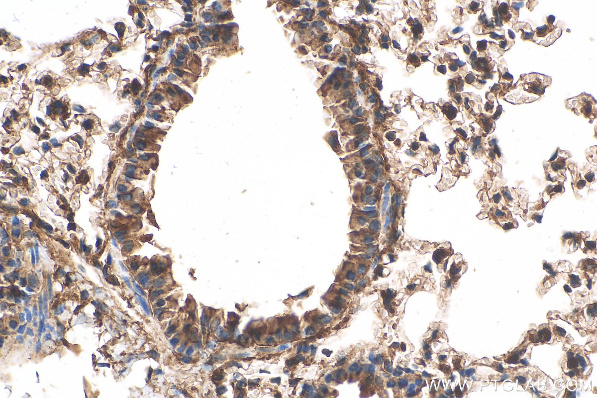 Immunohistochemistry (IHC) staining of mouse lung tissue using LPCAT1 Polyclonal antibody (16112-1-AP)