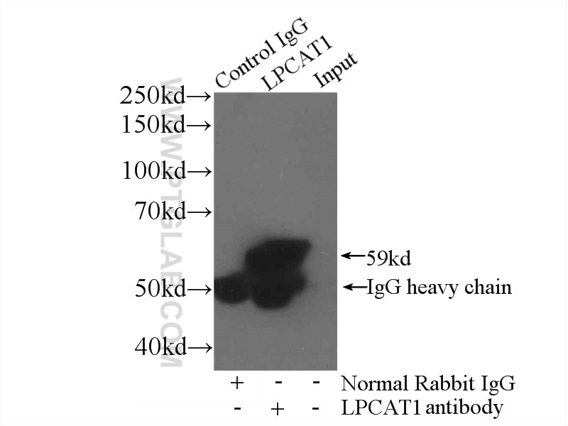 Immunoprecipitation (IP) experiment of mouse brain tissue using LPCAT1 Polyclonal antibody (16112-1-AP)