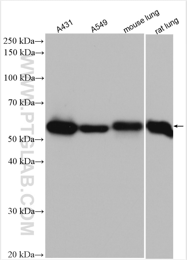 Western Blot (WB) analysis of various lysates using LPCAT1 Polyclonal antibody (16112-1-AP)