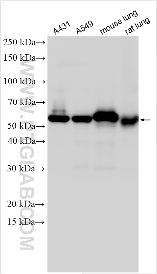 Western Blot (WB) analysis of various lysates using LPCAT1 Polyclonal antibody (16112-1-AP)