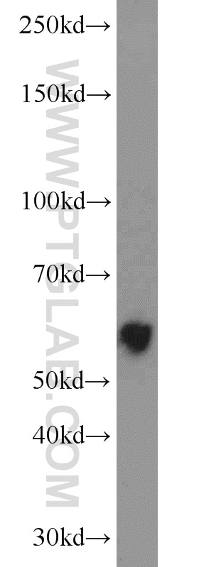 Western Blot (WB) analysis of human lung tissue using LPCAT1 Polyclonal antibody (16112-1-AP)