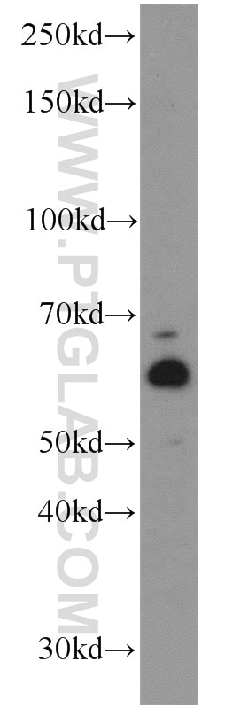 Western Blot (WB) analysis of mouse spleen tissue using LPCAT1 Polyclonal antibody (16112-1-AP)