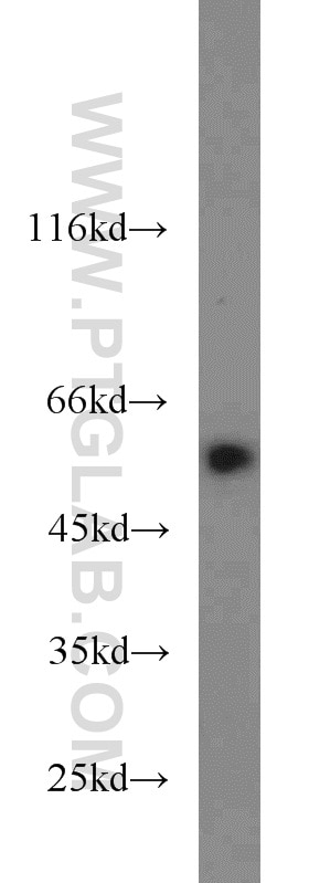Western Blot (WB) analysis of mouse brain tissue using LPCAT1 Polyclonal antibody (16112-1-AP)