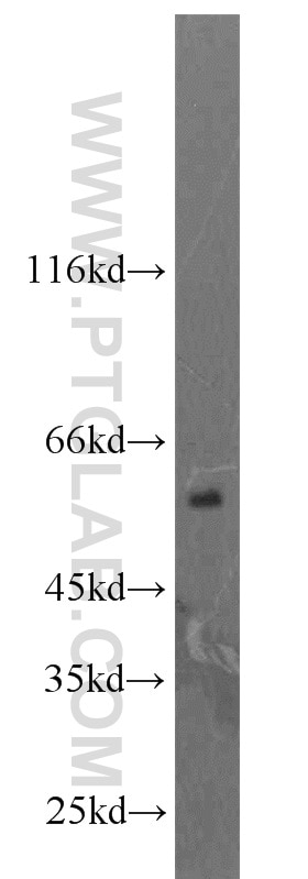 Western Blot (WB) analysis of rat brain tissue using LPCAT1 Polyclonal antibody (16112-1-AP)