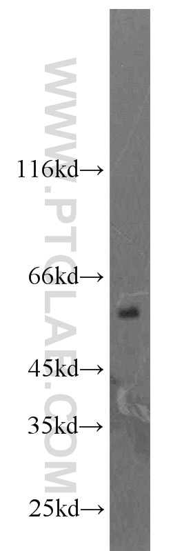 WB analysis of rat brain using 16112-1-AP