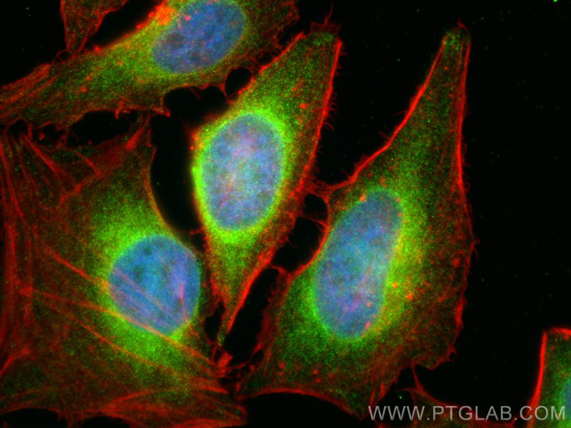 Immunofluorescence (IF) / fluorescent staining of HeLa cells using LPCAT1 Monoclonal antibody (66044-1-Ig)