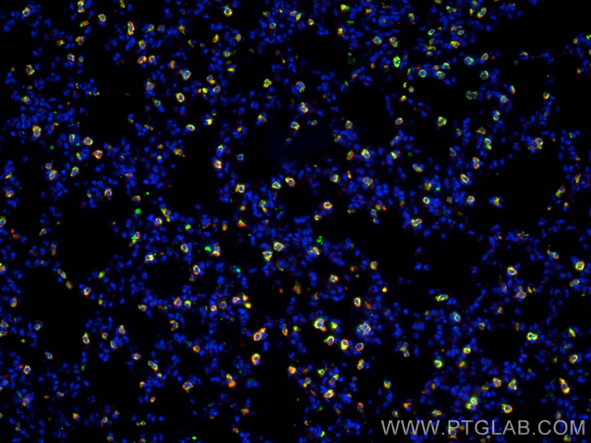 Immunofluorescence (IF) / fluorescent staining of mouse lung tissue using LPCAT1 Monoclonal antibody (66044-1-Ig)