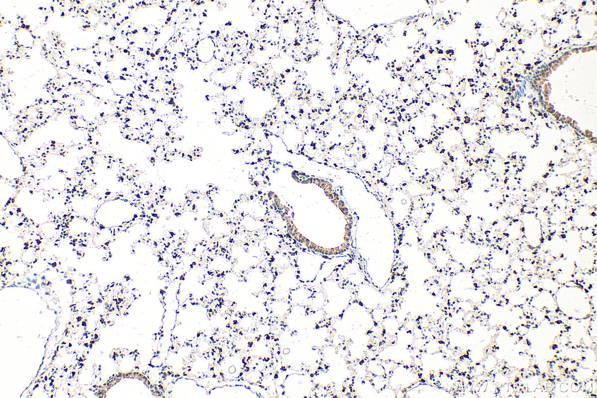 Immunohistochemistry (IHC) staining of mouse lung tissue using LPCAT1 Monoclonal antibody (66044-1-Ig)