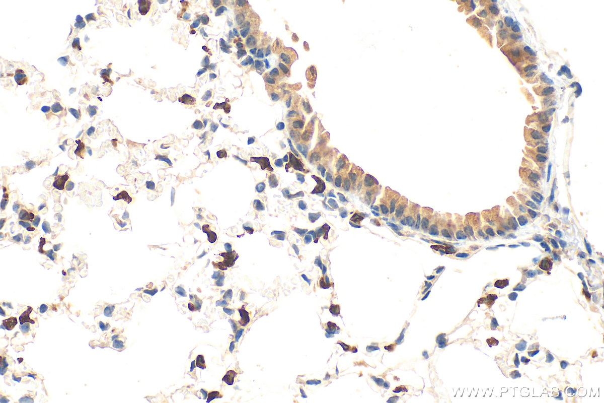 Immunohistochemistry (IHC) staining of mouse lung tissue using LPCAT1 Monoclonal antibody (66044-1-Ig)