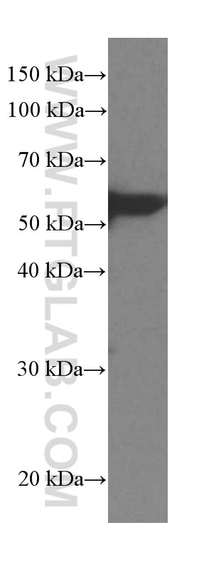 Western Blot (WB) analysis of ROS1728 cells using LPCAT1 Monoclonal antibody (66044-1-Ig)