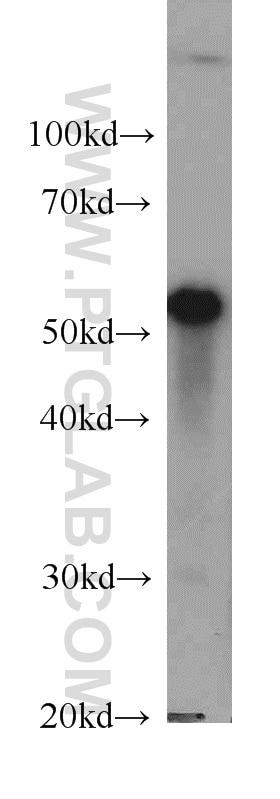 Western Blot (WB) analysis of MCF-7 cells using LPCAT1 Monoclonal antibody (66044-1-Ig)